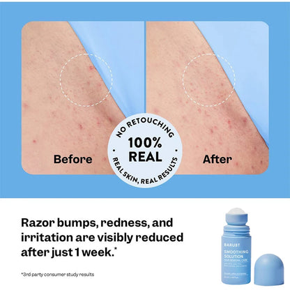 DermaEase: Smoothing Solution Ingrown Hair Treatment